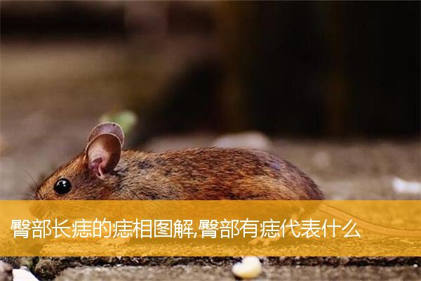 臀部长痣的痣相图解,臀部有痣代表什么