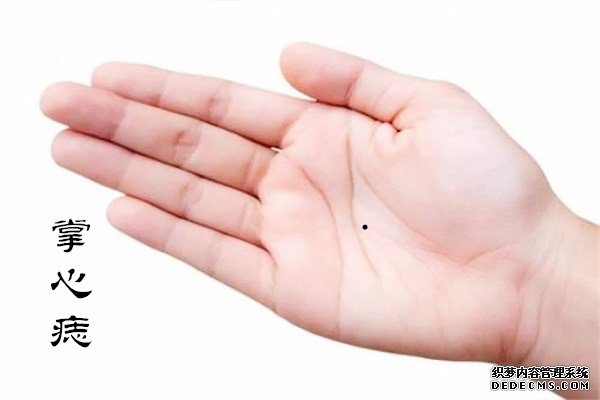 痣相分析:掌心有痣代表什么,掌心有痣的人性格如何?