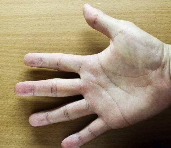 女人手上有凤尾纹代表什么意思
