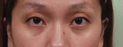 眼睛面相图解: 从眼睛看出你的婚姻运势!