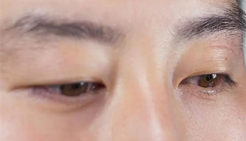 男人左眼跳是吉还是凶,男人左眼跳是什么预兆