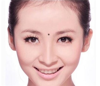 痣相图解:哪些痣不能点掉?这些痣真的不能留!