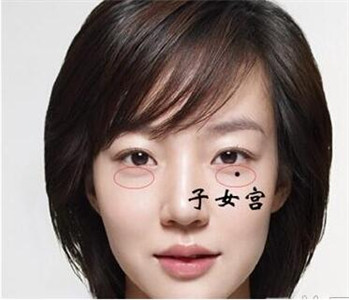 痣相图解:哪些痣不能点掉?这些痣真的不能留!
