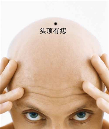 男人10处有痣是富贵痣!男人什么地方长痣最好命?