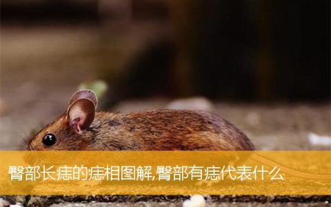 臀部长痣的痣相图解,臀部有痣代表什么