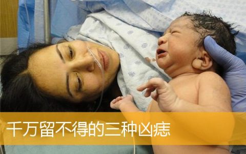 千万留不得的三种凶痣
