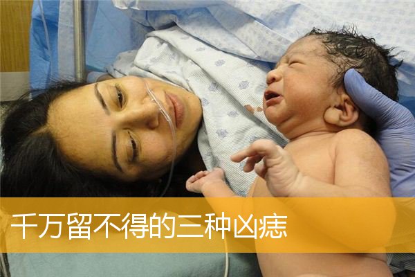 千万留不得的三种凶痣