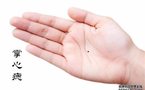 痣相分析：掌心有痣代表什么，掌心有痣的人性格如何？