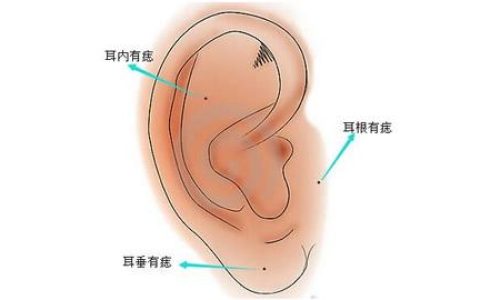 耳朵有痣图解对照表