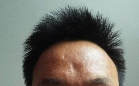 额头凹陷的面相分析
