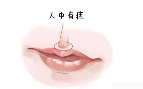 看相识人女人人中有痣者好吗?