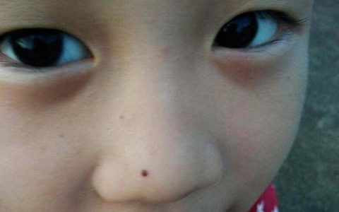 男人哪里长痣最有福气？痣相解读男人运！