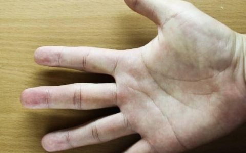 女人手上有凤尾纹代表什么意思