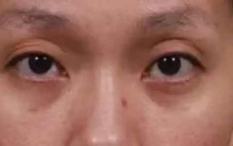 眼睛面相图解: 从眼睛看出你的婚姻运势！