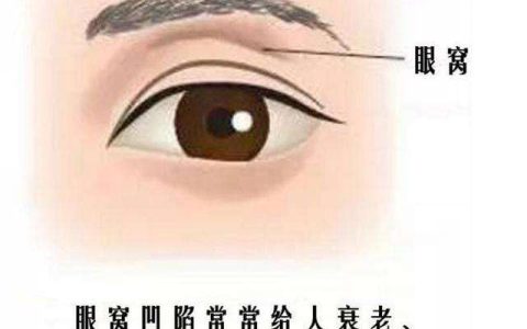 眼睛面相图解：眼窝凹陷的人命运如何？