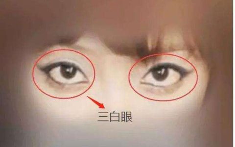 女人面相分析：下三白眼的女人命运如何？