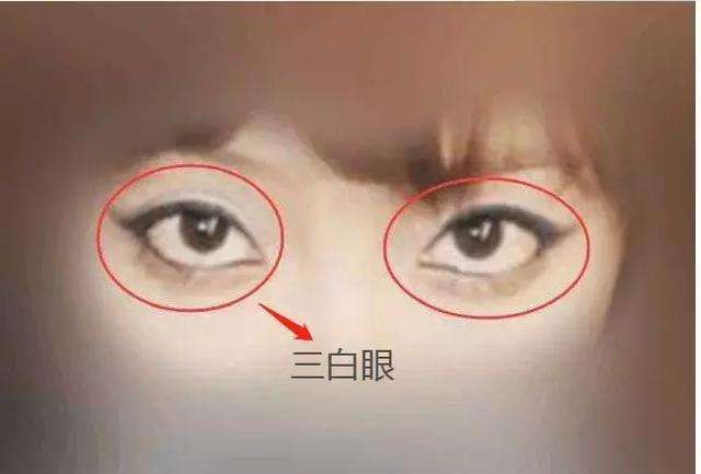女人面相分析：下三白眼的女人命运如何？