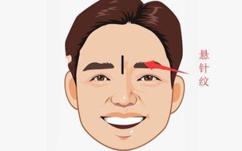 额头有悬针纹代表什么？要如何破解呢？