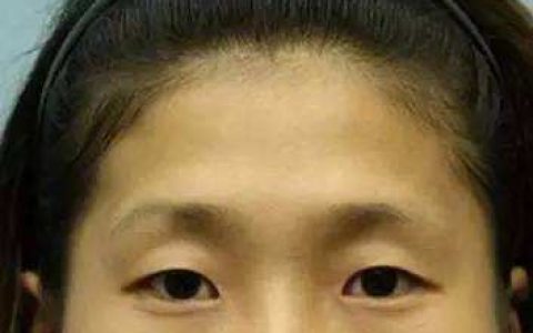 额头凹陷面相分析：这是一个不吉的面相！