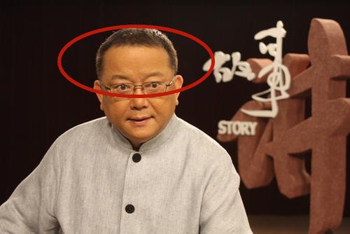 额头面相图解：从发际线就能看出你的的性格和运势 ！