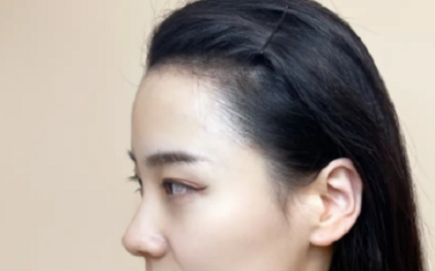 女性额头宽大发际线高面相好不好？