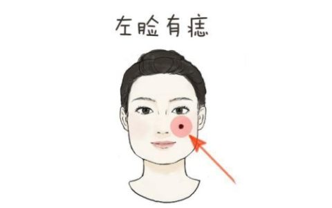 左脸有痣的女人代表什么