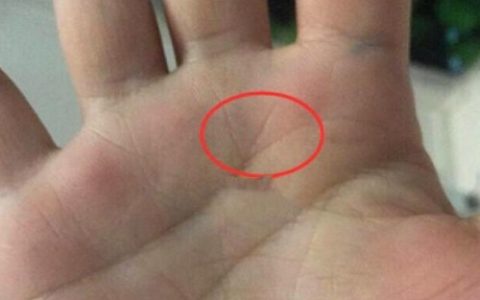 凤尾纹过了40岁就成绝户了吗