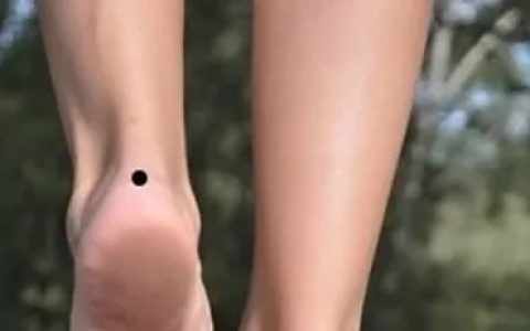 左脚脚后跟有痣的女人代表什么
