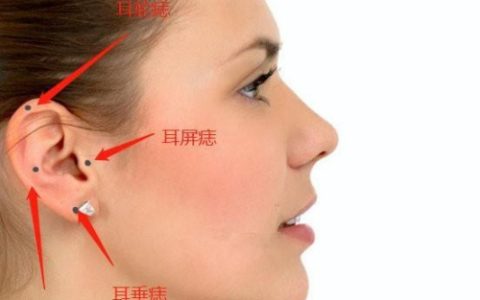 女人右耳朵有痣代表什么