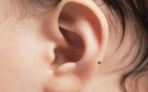 女人耳朵有痣代表什么意思