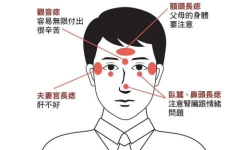 面部哪些痣必须点掉