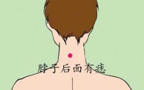 后脖上有痣的女人婚姻好吗