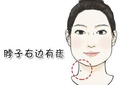 女人右脖子最吉利的痣