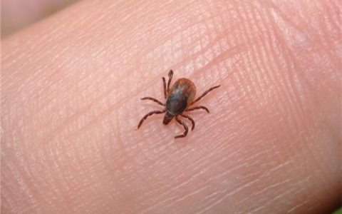 梦见头上长虱子并掐死是什么意思