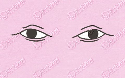 什么叫厌世眼 厌世眼命运如何