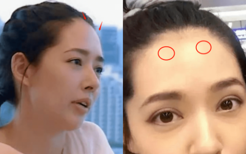 面相额头有骨隆起说法