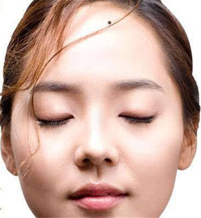 女人10处有痣是富贵痣，这些身体部位长痣代表财富！